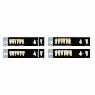 RĂNG composite tháo lắp SCHOTTLANDER - Vĩ